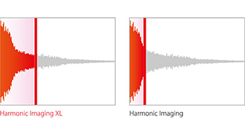 Harmonic Imaging XL